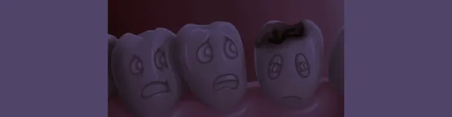 Blog header tooth with a cavity in it
